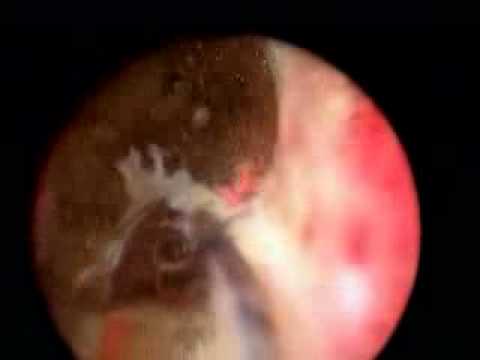 Was die Symptome der Prostatitis bei Männern Prostatitis bei Männern als bei Frauen gefährlich ist