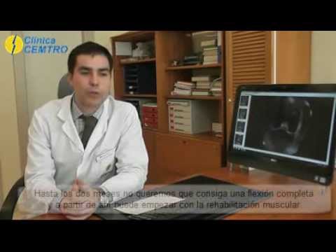 Cirugía para la rotura de ligamentos
