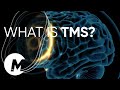 What Is TMS How Does TMS Work MagVenture TMS Therapy