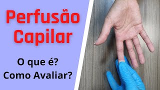 Perfusão Capilar - O que é e Como Avaliar? - Ronaldo Mendes Bombeiro - Parte 21 de 365