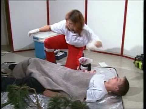 download lagu mp3 mp4 Amputationsverletzung, download lagu Amputationsverletzung gratis, unduh video klip Amputationsverletzung