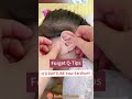 Ear Cleaning Asmr Satisfying Removel Shorts