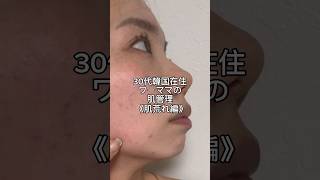 【30代韓国在住ワーママの肌管理】《肌荒れ編》