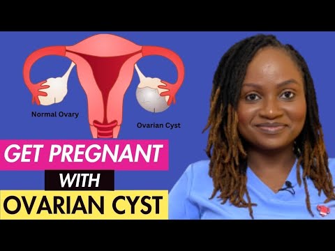 HOW TO GET PREGNANT WITH OVARIAN CYST