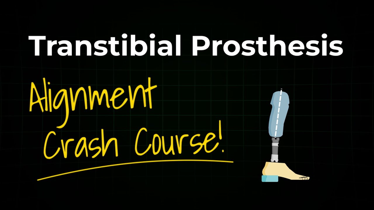 Transtibial Prosthesis - Workbench Alignment - Tutorial!