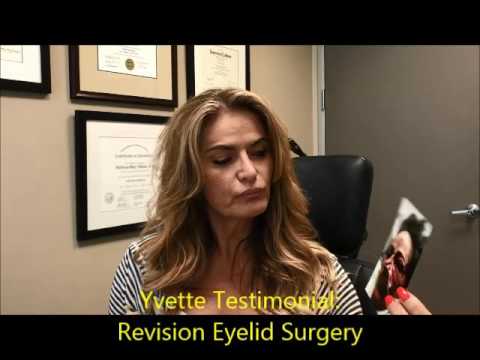 Testimonial for Revision Droopy Eyelid (Ptosis) Surgery Testimonial for Revision Droopy Eyelid (Ptosis) Surgery