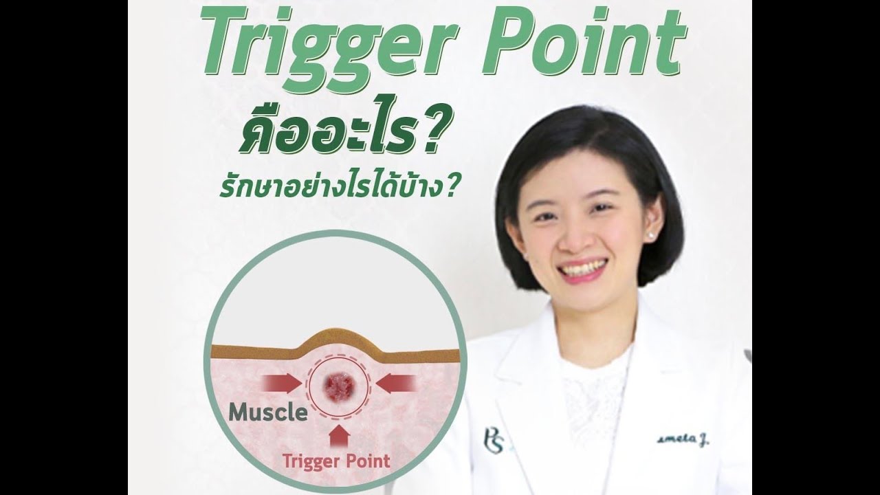 Trigger Point หรือ ปมกล้ามเนื้อ คืออะไร ปวดเกร็ง กล้ามเนื้อเป็นก้อน เกิดจากสาเหตุอะไร