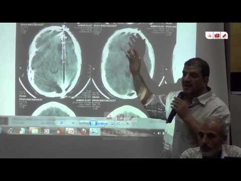  نقابة الاطباء توضح انواع المقذوفات بأجساد الشهداء بمجزرة رابعة