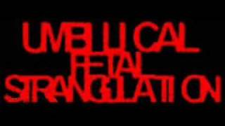 Umbilical Fetal Strangulation - Brutally Mutilated(Mortician Cover)