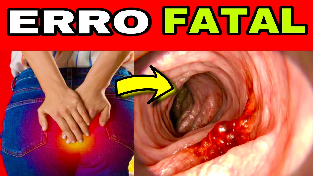 7 SINAIS de ALERTA do CÂNCER de INTESTINO e 3 ERROS que VOCÊ NUNCA pode COMETER