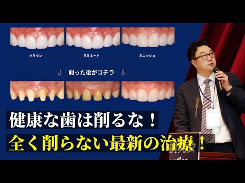 この新しい歯のセンサーは栄養分析を目的としています