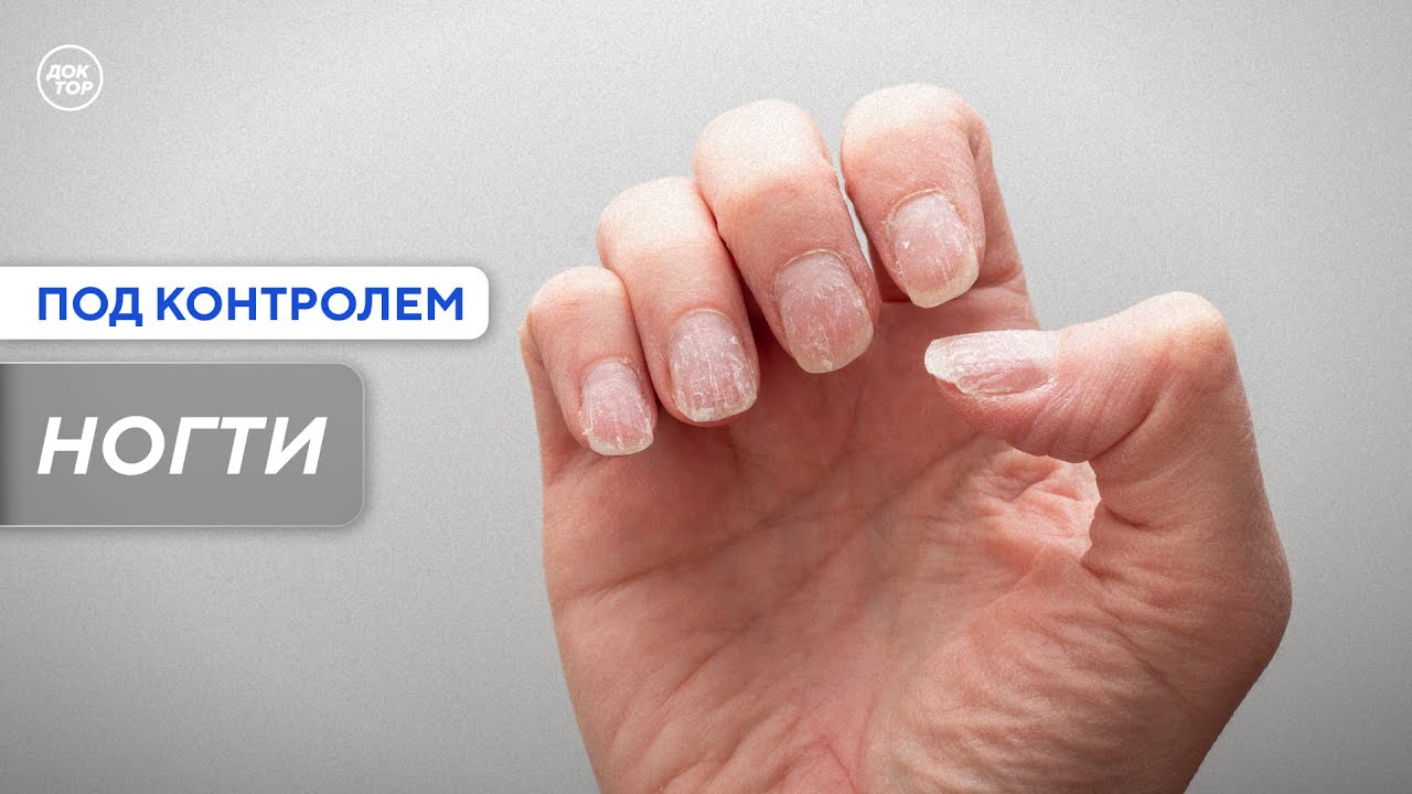 Как по ногтям заподозрить проблемы с сердцем или печенью / Под контролем