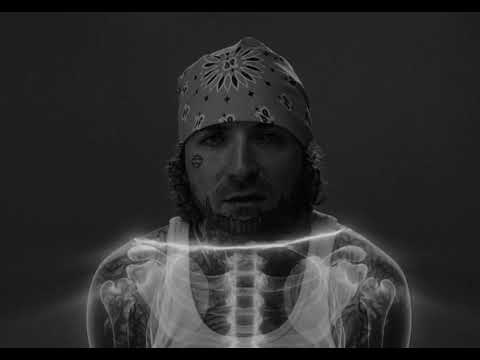 Caskey - Dave Chapelle Ft. ClicKlak (Official Music Video)