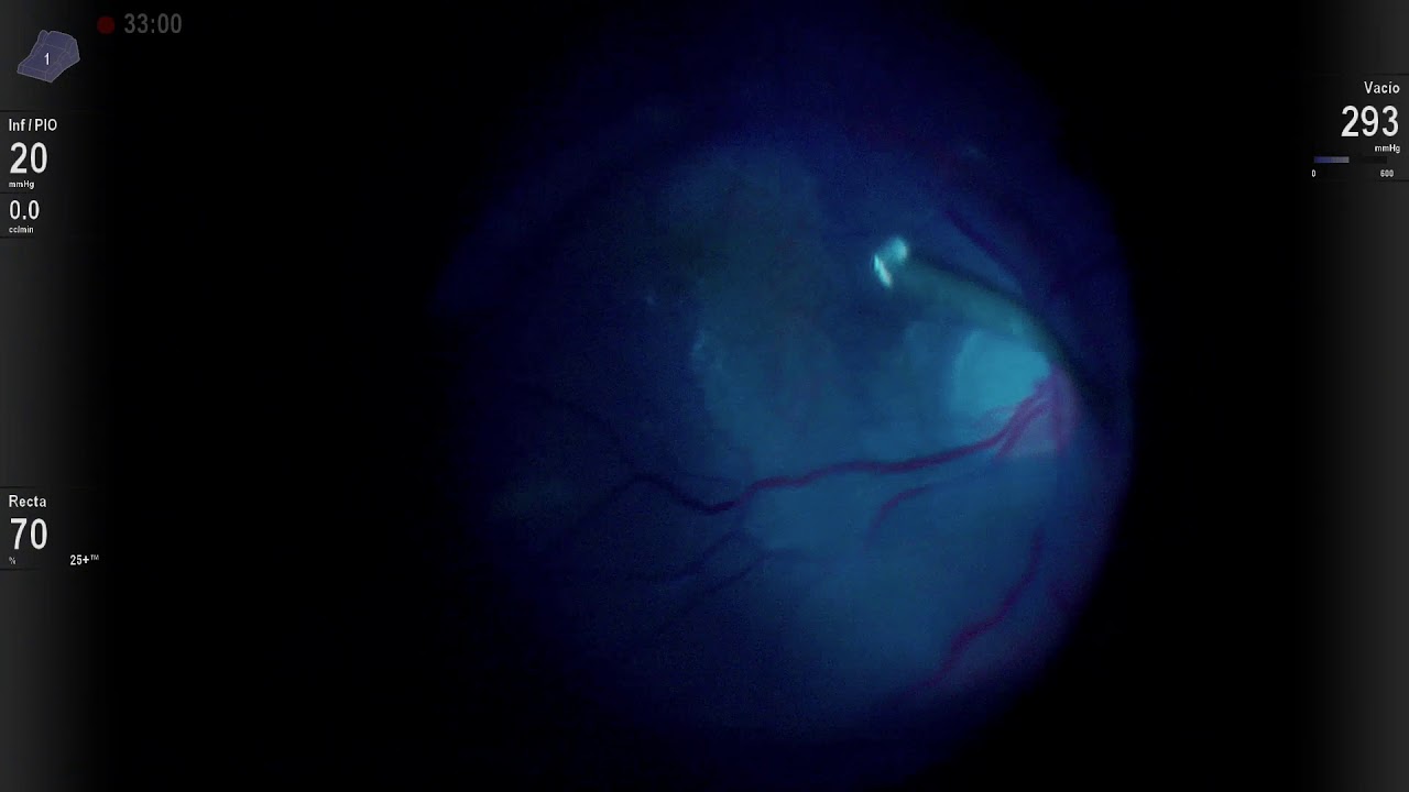 Marco Antonio Rayón Rodríguez-14