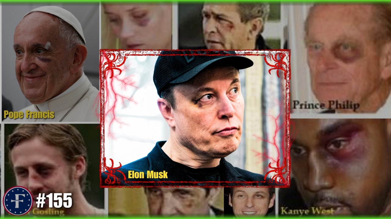 Elon's Black Eye: Innocent Fun or Ritual Initiation? | Matt Kim #155