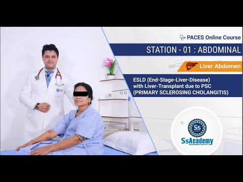 PACES 2023 New Format | Station - 01 End-Stage - Liver - Disease with Liver-Transplant due to PSC