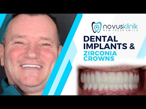 Logo of Full Mouth Dental Implants and Zirconium Restorations in Istanbul, Turkey – Benefits and Process
