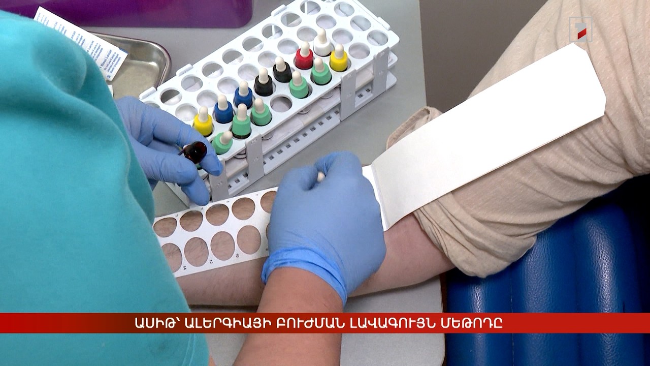 ԱՍԻԹ՝ ալերգիայի բուժման լավագույն մեթոդը