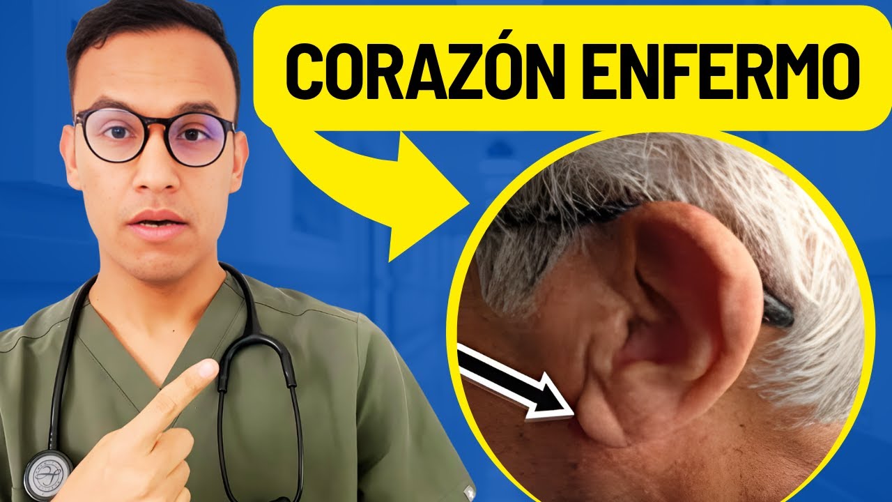 13 señales VISIBLES de un CORAZÓN ENFERMO