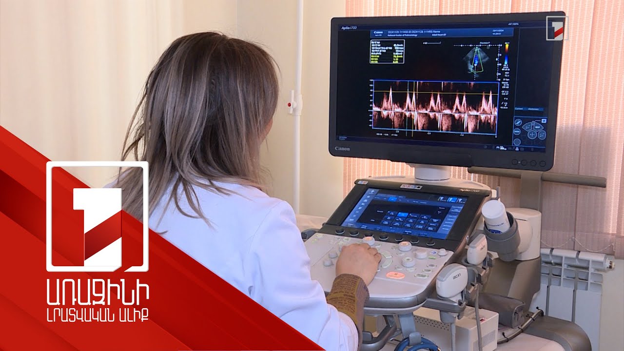 Նոր սարքավորումներով բուժհաստատությունների համալրումը 2025-ին գրեթե կկրկնապատկվի