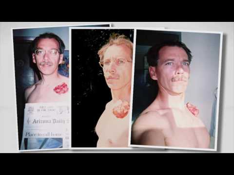 Healing Journeys, Week 2, Day 3 - Healed of a tumor -The Gospel Truth