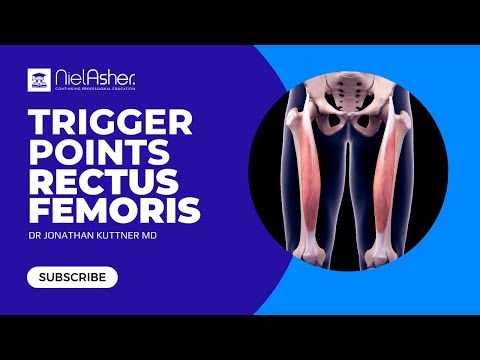 Rectus Femoris - Trigger Point Anatomy