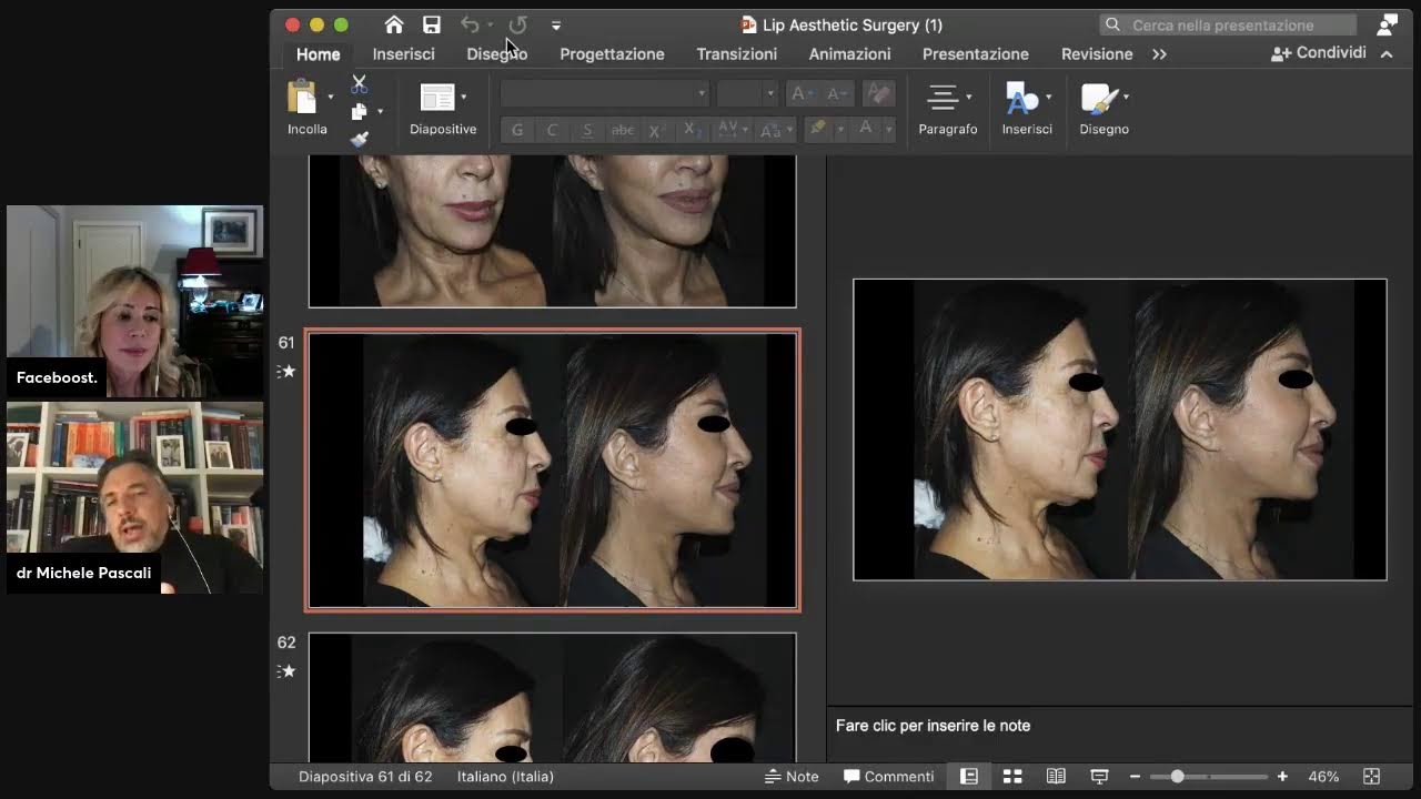 Il Lip lift e il rino lip lift: interviene il dott. Michela Pascali