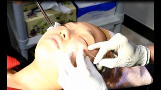 Non- Surgical Thread Lifting for Perfect Skin in South Korea