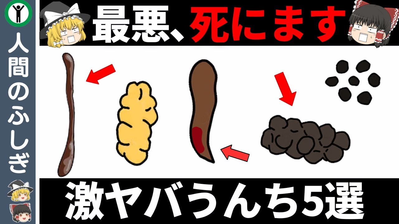 【これでたら病院行け！】見逃したら死ぬヤバい便5選【便器でわかる寿命】【ゆっくり解説】