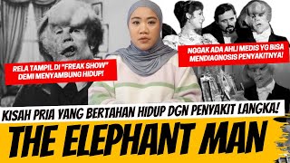 Download lagu KISAH HIDUP SEORANG LAKI-LAKI YANG DIJULUKI “MANUSIA GAJAH”. mp3 Download lagu KISAH HIDUP SEORANG LAKI-LAKI YANG DIJULUKI “MANUSIA GAJAH”. mp3