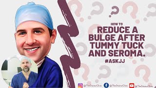 How to reduce a bulge after tummy tuck and seroma