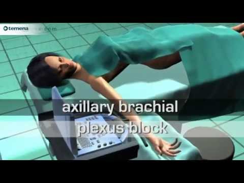 Axillary brachial plexus block