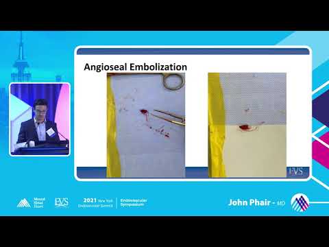 Complications and Bailouts Acute Vessel Closure Case - John Phair, MD