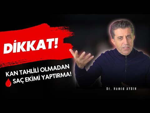 Bu Kan Tahlilini Yapmazsan Saçların Riskte!