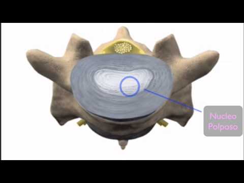Osteocondrosi di aceto di mele Crunch e tutte le articolazioni periodicamente male