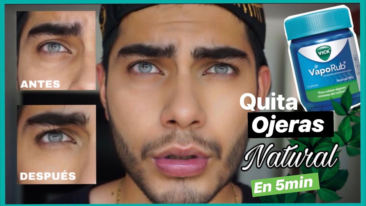 Watch Remedio Casero QUITAR OJERAS Rápido 🌿Natural #QuedateEnCasa Conmigo #EstiloRey Now Remedio Casero QUITAR OJERAS Rápido 🌿Natural #QuedateEnCasa Conmigo #EstiloRey
