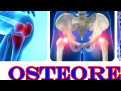 Artroza simptomelor tratamentului genunchiului