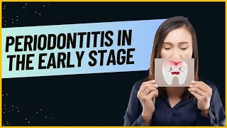 Periodontitis In The Early Stage: 4 Symptoms To Look For