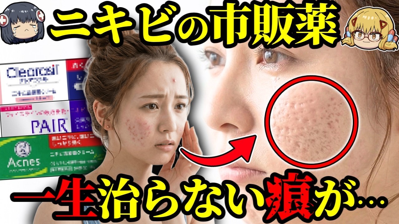 【ニキビ】後悔した時には遅い？市販薬を使い続けた12カ月後に起こること【ゆっくり解説】