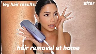 I TRIED LASER HAIR REMOVAL AT HOME... this is what happened...