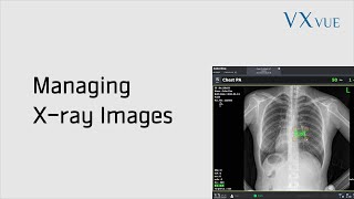 VXvue Quick Guide 04. Managing Tools for X-ray Images