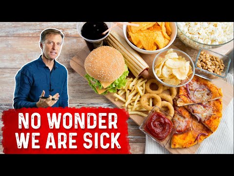 An APPLE a Day Will NOT Let Your Weight Go Away – Dr Berg