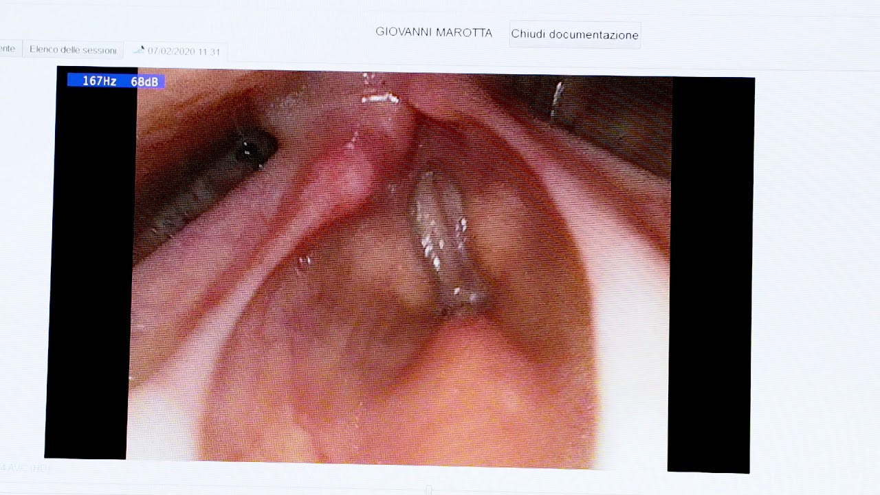 Antonio Tanzariello-20