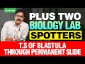 Plus Two Biology Lab Spotters T S Of Blastula Through Permanent Slide Xylem Plus Two