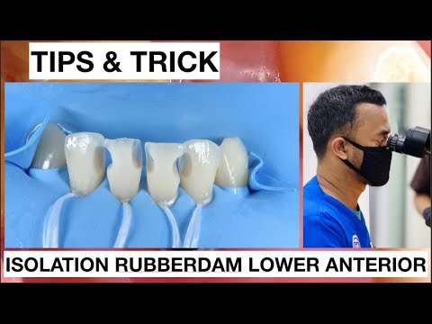 Tips and Trick Isolation With Rubberdam Lower Anterior Without Clamp