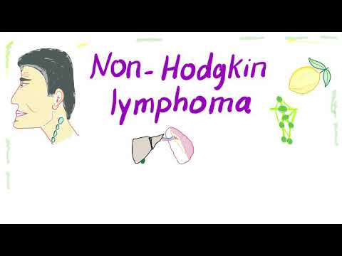 neuroendokrin rákkiütés petefészekrák áttét