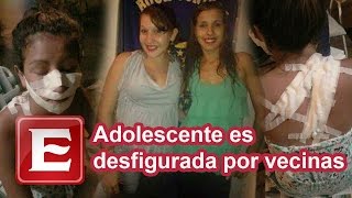 Adolescente teve rosto mutilado por ser muito linda