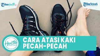Bikin Mulus, Begini Cara Ampuh Atasi Telapak Kaki Pecah-pecah dengan Bahan Alami: Madu & Cuka Apel
