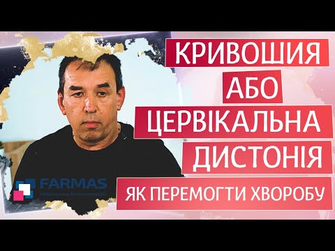Кривошея или цервикальная дистония. Как победить болезнь