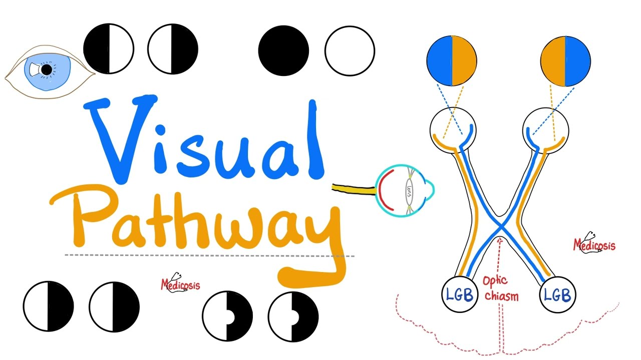 Visual Pathway & its defects - Optic nerve - Optic Chiasm - Optic tract - Lateral Geniculate Body